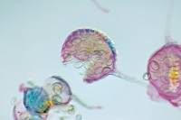 Polypode - Sporanges et spores de Polypode x40